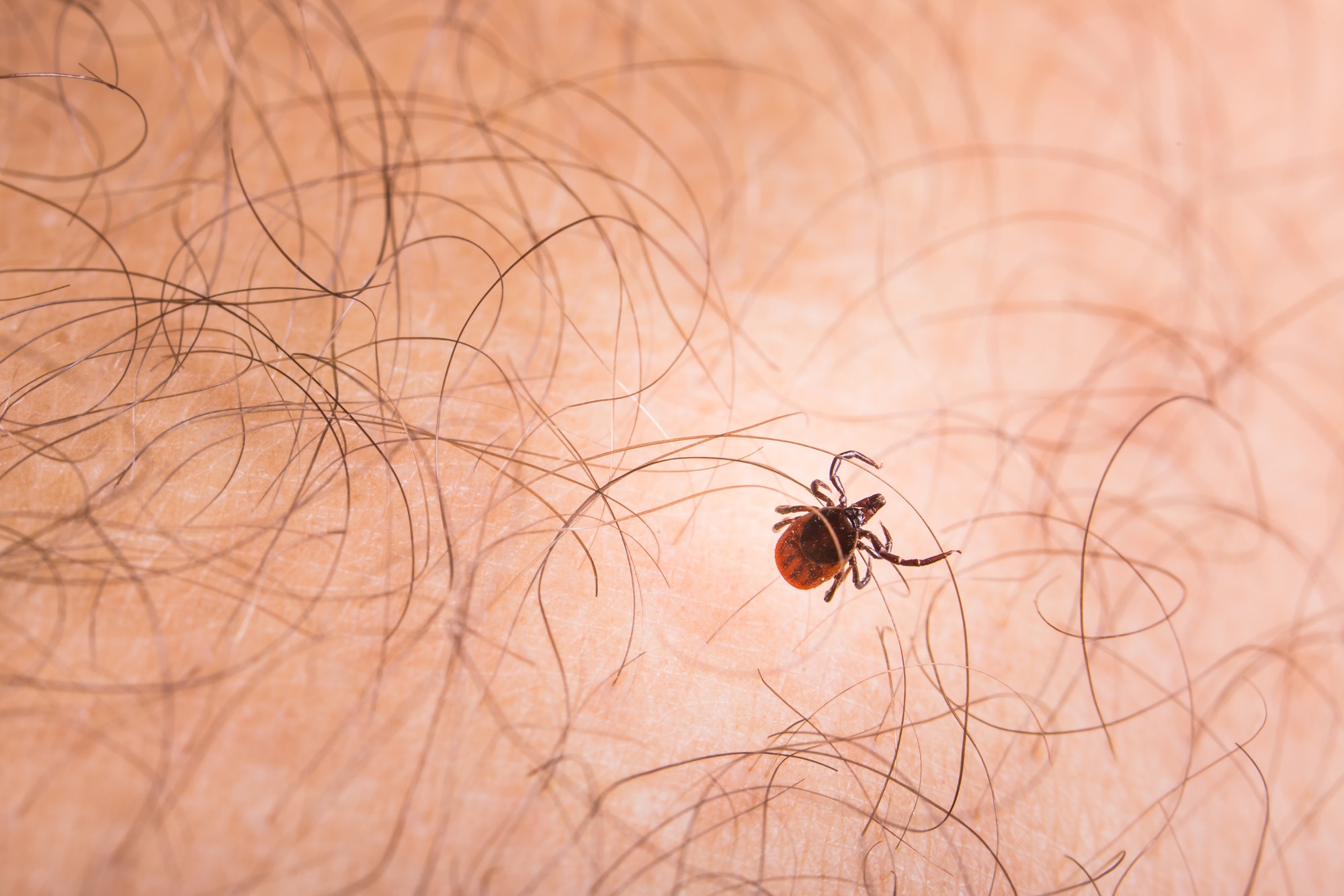 Why ticks are so dangerous to humans and pets — Catherine’s student essay